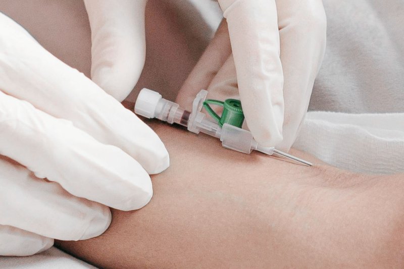 Umicore MDS - PLATUNA PT - Platinum coating for medical technology - Catheter technology and interventional medicine